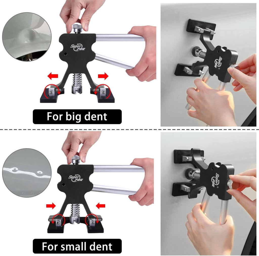 Paintless Dent Repair Kit with Bridge Dent Puller S958881